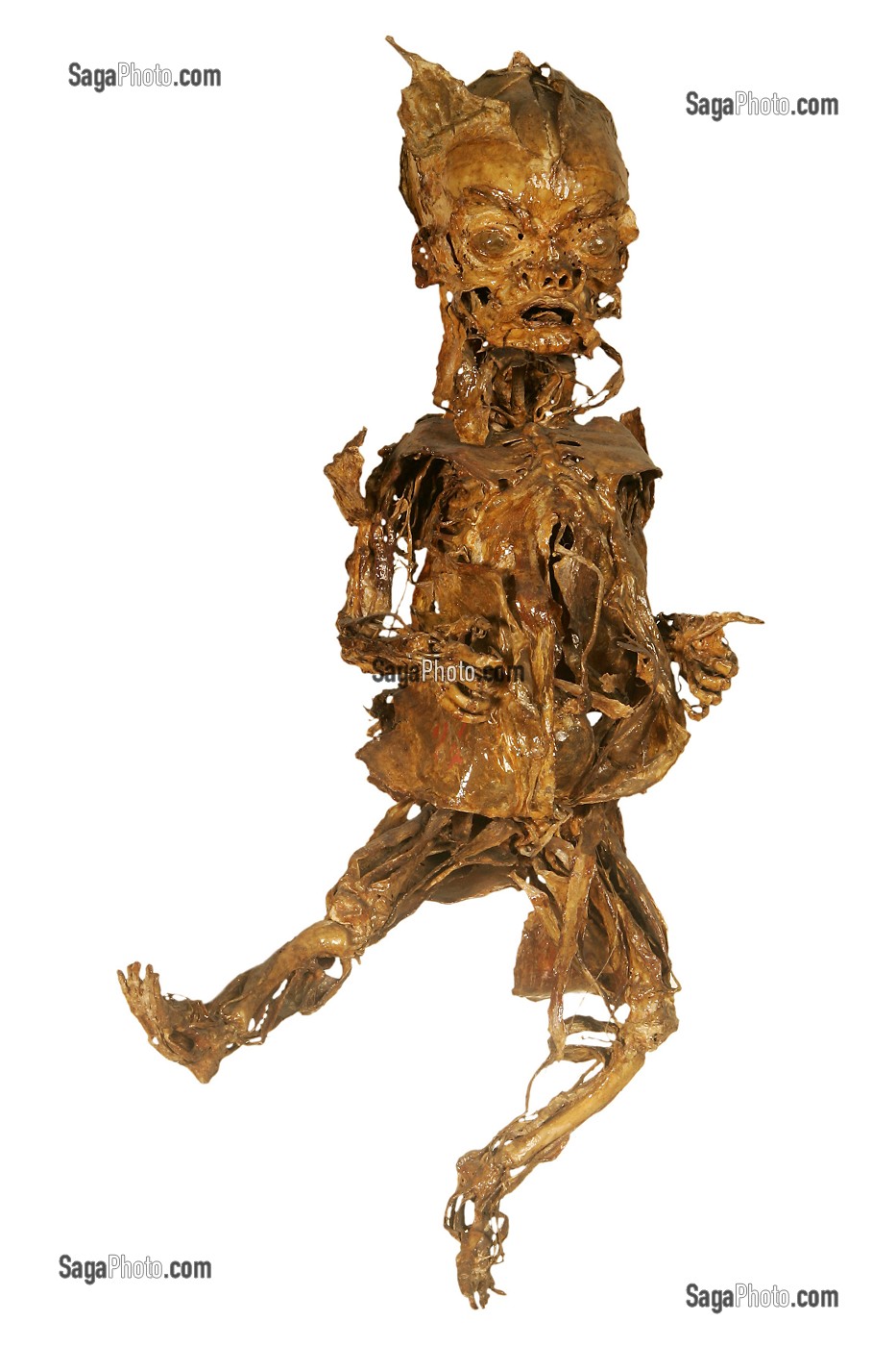 LE FOETUS DANSANT LA GIGUE, ECORCHE DE HONORE FRAGONARD, FIN XVIII EME, MUSEE FRAGONARD, ECOLE NATIONALE VETERINAIRE D'ALFORT, MAISONS-ALFORT, VAL-DE-MARNE (94), FRANCE 