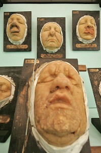 MALADIE DU VISAGE, MUSEE DE LA MEDECINE, HOTEL-DIEU, SAINT-CYPRIEN, TOULOUSE, HAUTE-GARONNE (31), FRANCE 