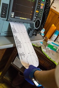EXAMEN ELECTROCARDIOGRAMME ET PRISE DE SANG LORS D'UNE INTERVENTION A DOMICILE POUR UN HOMME SE PLAIGNANT D'UNE DOULEUR A LA POITRINE, COMMUNE DE BONNAC, SAMU DU VAL D'ARIEGE, PAMIERS (09), FRANCE 